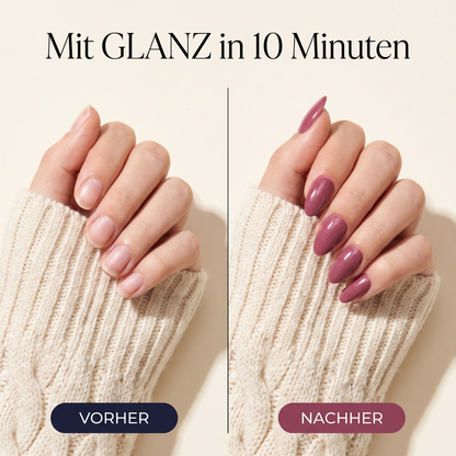 GLANZ Gel-Nagelstift Set